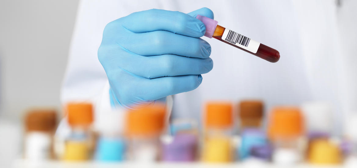 Molecular Blood Test 